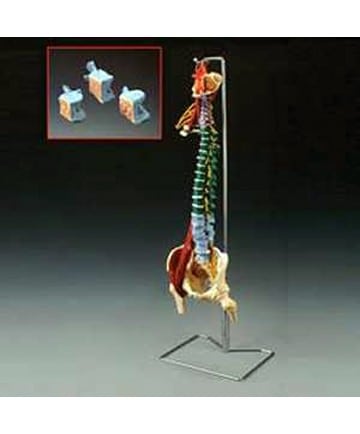 Muscle Spine With Disorders with Stand