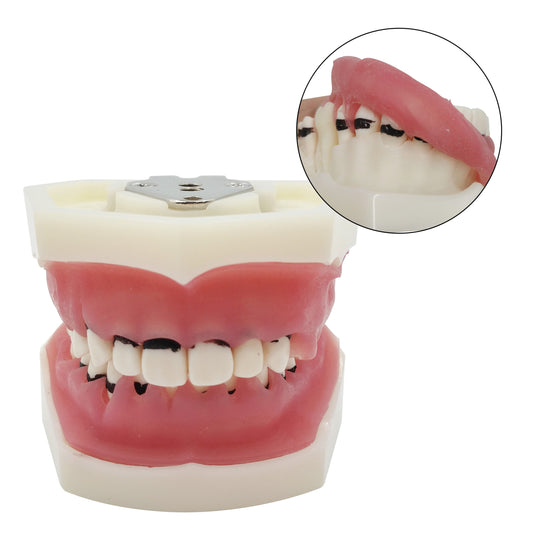 Dental Periodontal Disease Teeth Model Dental Teeth Model For Medical Teaching