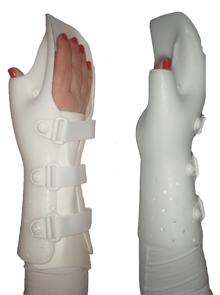 Functional Positioning Orthosis Left
